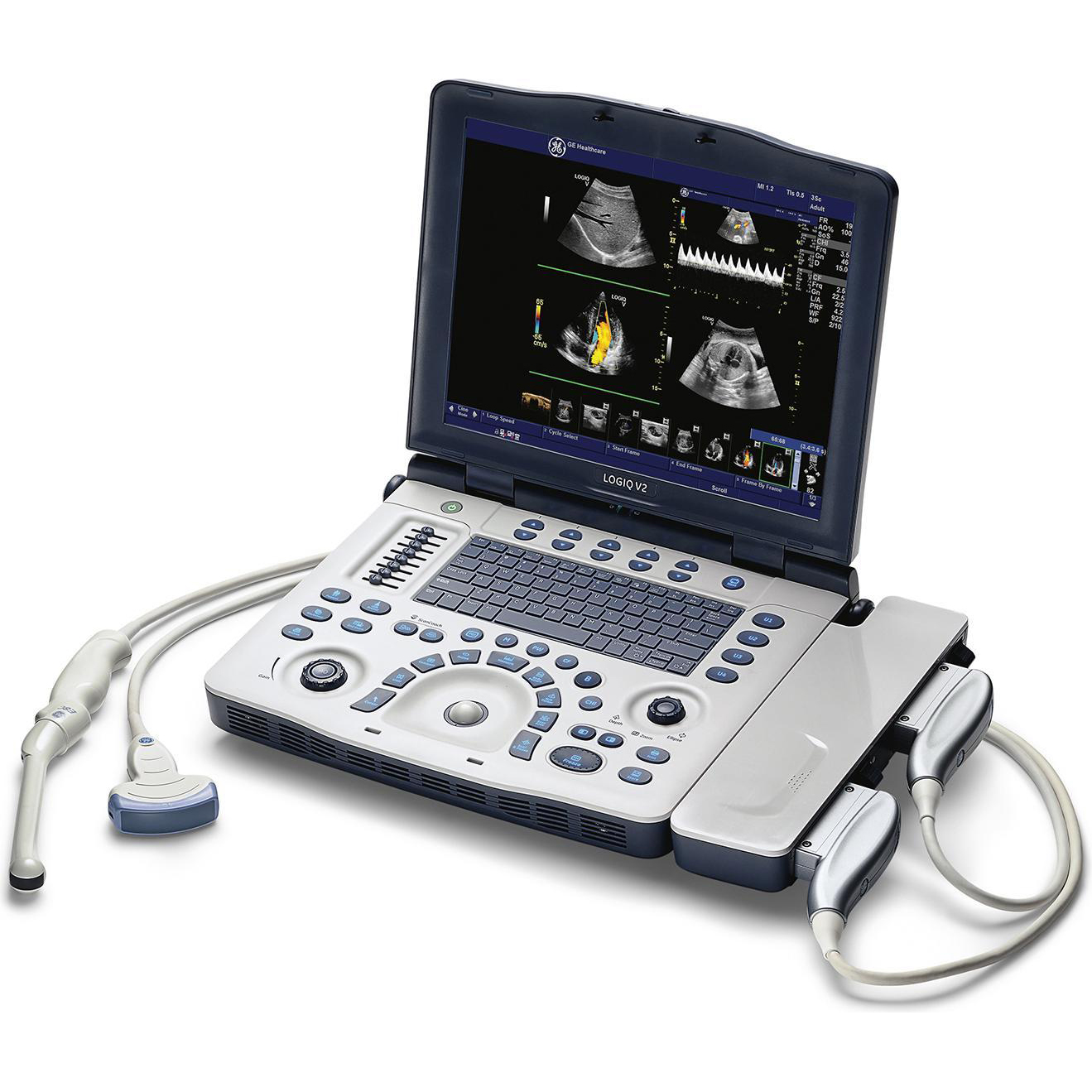 Produto - Ultrassom Portátil GE Logiq V2