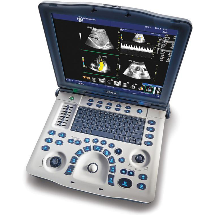 Produto - Ultrassom Portátil GE Logiq V2