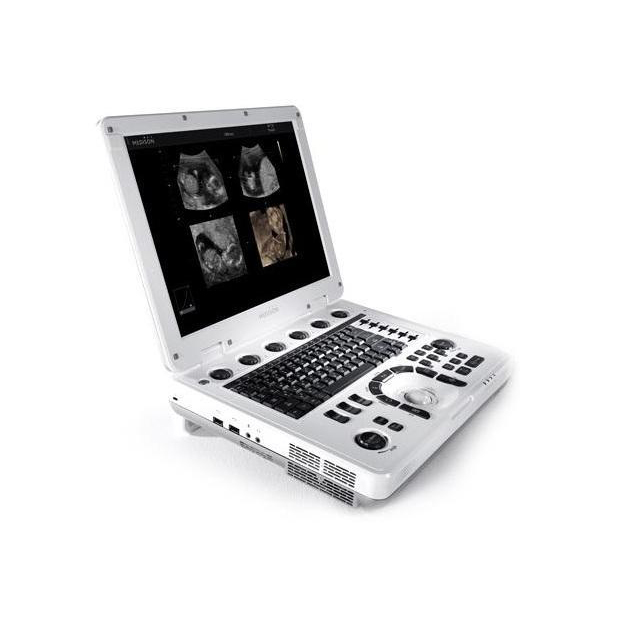 Produto - Ultrassom Portátil Samsung MySono U6