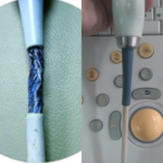 Imagem de TROCA DE MEMBRANA